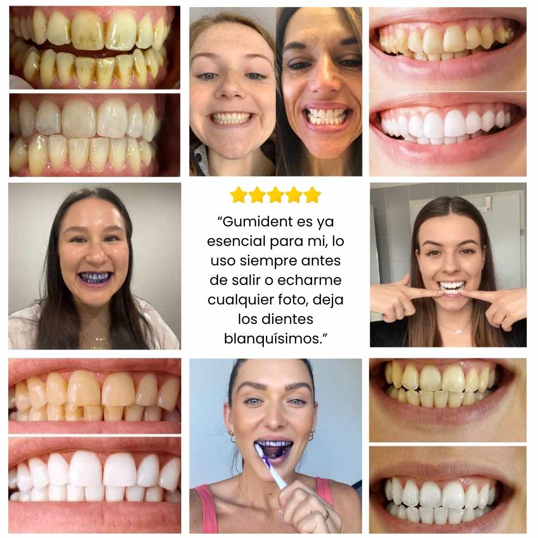 Dientes Blancos al Instante - GumiDent V34