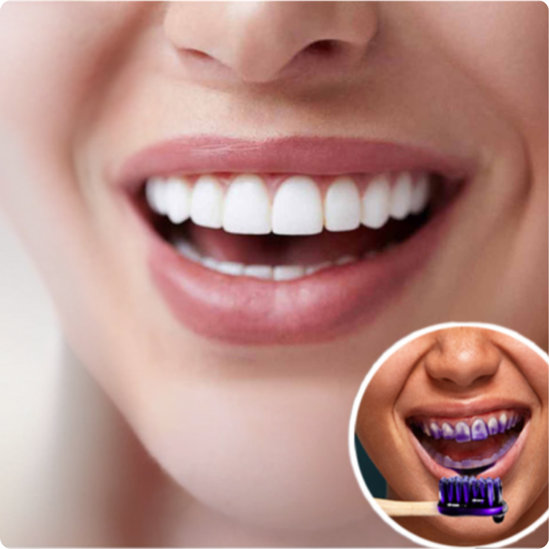 Dientes Blancos al Instante - GumiDent V34