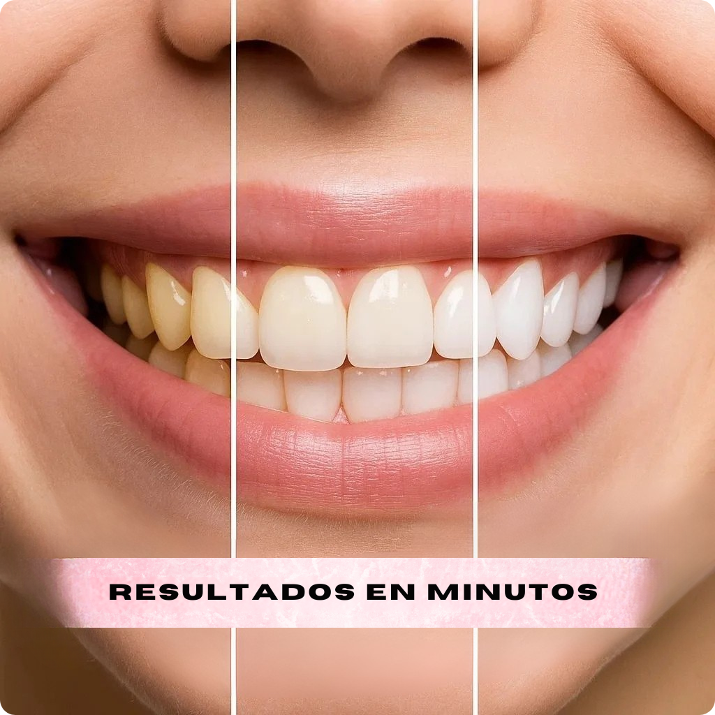 Dientes Blancos al Instante - GumiDent V34